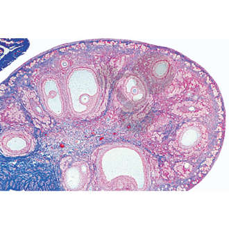 Histologia: żeńskie narządy płciowe, 10 preparatów mikroskopowych