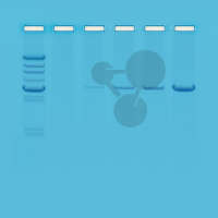 Reakcja łańcuchowa polimerazy (PCR), - wprowadzenie